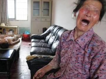 Bé gái suýt mất mạng vì bà tiếc tiền mua sữa mà cho ăn theo cách chết người