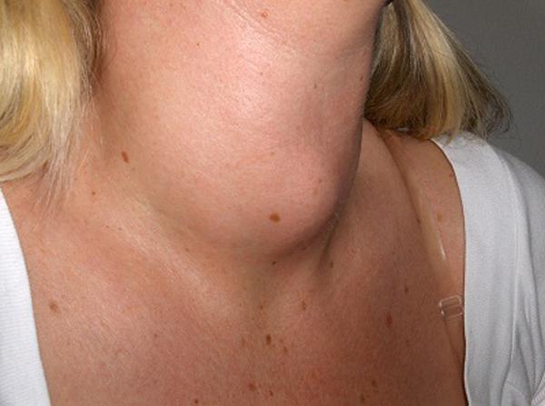 Sau khi hỏi nữ bệnh nhân ung thư một câu, bác sĩ liền yêu cầu cô đưa con trai tới - 3