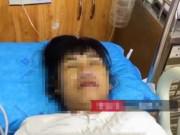 Sức khỏe - Một người tử vong, một người suýt chết chỉ vì loài côn trùng nhỏ bé có mặt ở nhiều nơi