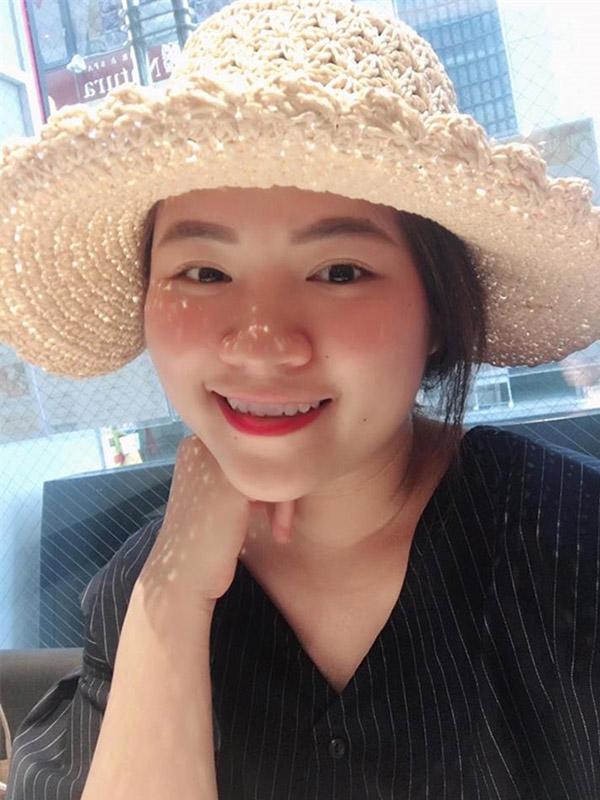 Nhờ điều này, không ai tin được làn da của cô nàng đã từng bị “tàn phá” bởi kem trộn! - 2