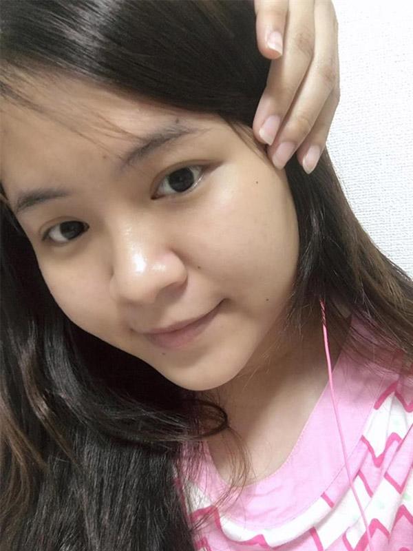 Nhờ điều này, không ai tin được làn da của cô nàng đã từng bị “tàn phá” bởi kem trộn! - 3