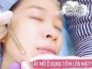 Làm đẹp - Cấy mỡ ở bụng rồi tiêm lên mặt, da được trẻ hóa vĩnh viễn, thực hư ra sao?