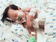 Sức khỏe - Sốc: Bé gái 10 tháng tuổi thủng thực quản, phổi kháng tất cả kháng sinh