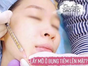 Cấy mỡ ở bụng rồi tiêm lên mặt, da được trẻ hóa vĩnh viễn, thực hư ra sao?