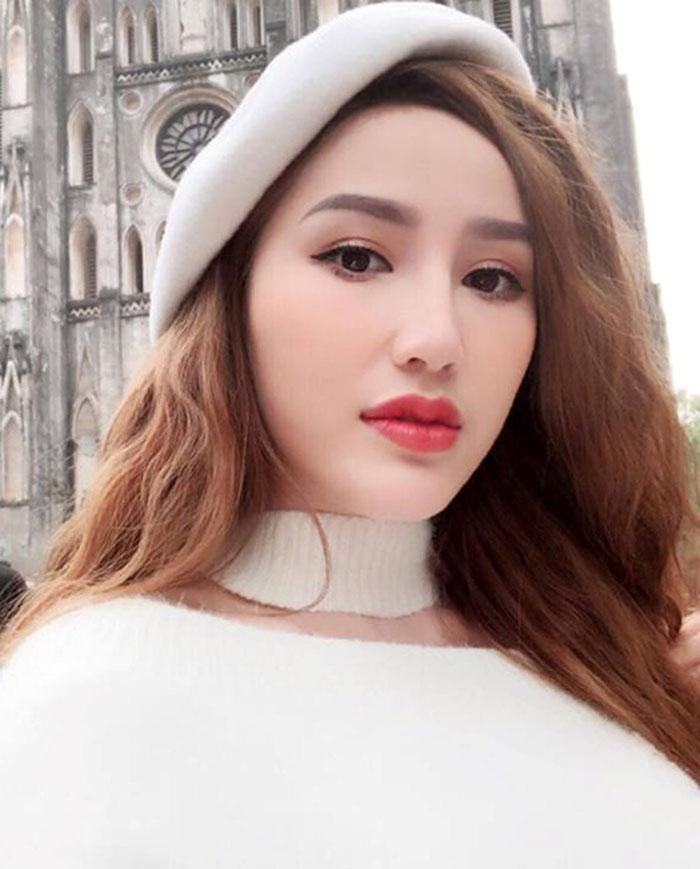amp;#34;Mẹ đẻ trào lưu môi tềuamp;#34; đã rút sạch filler, sao Việt chạy theo phong trào này giờ ra sao? - 9