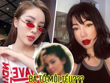 Mẹ đẻ trào lưu môi tều đã rút sạch filler, sao Việt chạy theo phong trào này giờ ra sao?
