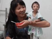 Làm mẹ - Não "đóng cửa", cô bé 3,5 tuổi giấu mình trong thân hình bé sơ sinh cao chỉ 54 cm