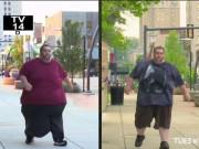 Tin tức - Bi kịch của người đàn ông có của quý khổng lồ, nặng gần 32kg