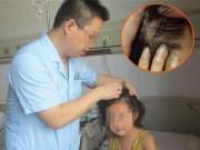 Làm mẹ - Con gái sốt cao mãi không khỏi cho đến khi vạch tóc lên, cả mẹ và bác sĩ đều rùng mình