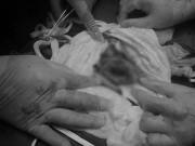 Sức khỏe - Thai phụ bàng hoàng bị vỡ tử cung: 2 dấu hiệu bà bầu đừng chủ quan kẻo hối không kịp