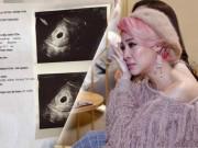 Bà bầu - Chưa kịp vui mừng vì sắp làm mẹ, Pha Lê đau đớn nhận tin sảy thai sau 1 tuần