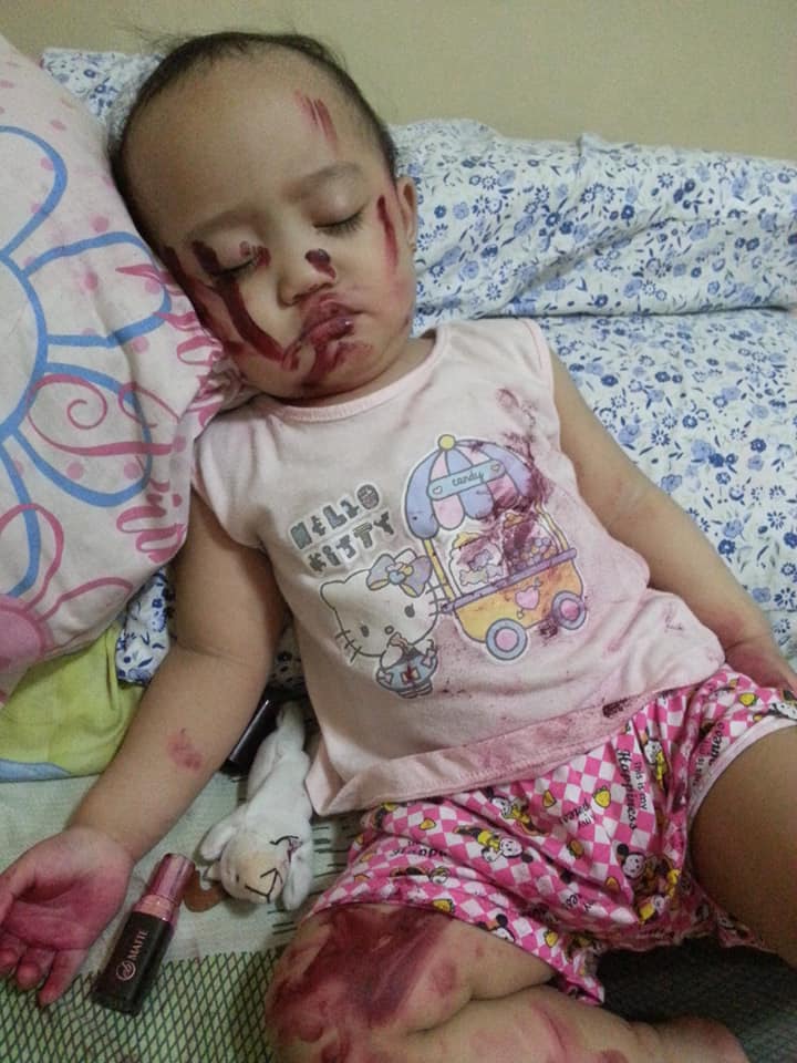 Tỉnh dậy giữa đêm thấy con gái amp;#34;ngất lịmamp;#34; với nhiều vết đỏ trên người, mẹ đau tim suýt ngất - 1