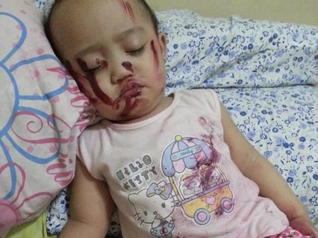 Tỉnh dậy giữa đêm thấy con gái ngất lịm với nhiều vết đỏ trên người, mẹ đau tim suýt ngất