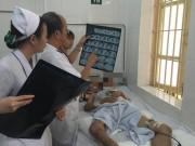 Sức khỏe - Người đàn ông nhiễm khuẩn huyết nguy kịch từ một vết xước, vi khuẩn này cũng có thể hít phải