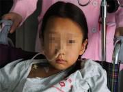 Yêu con - 3 món ăn nhiều trẻ Việt thích khiến cô bé 10 tuổi mắc ung thư tuyến giáp
