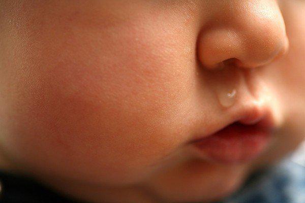 Bác sĩ chỉ cách trị sổ mũi cho trẻ sơ sinh tại nhà không cần dùng thuốc - 1