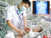 Làm mẹ - Chiếc ốc vít dài 3cm và trò đùa "hại em" của người chị gái 3 tuổi