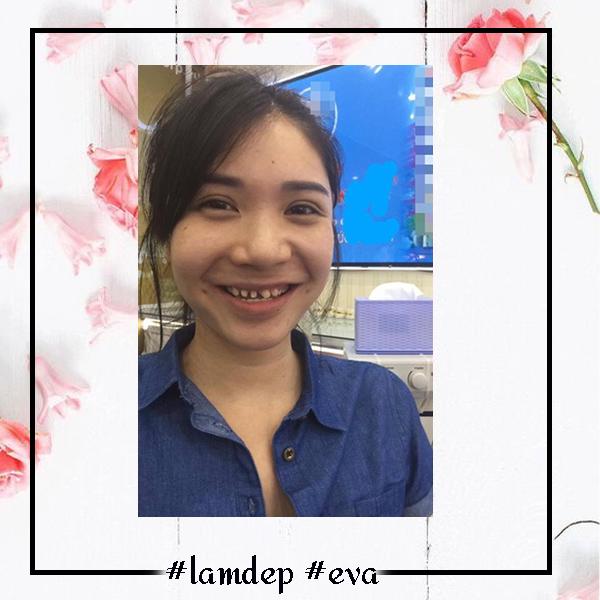 Thật uổng khi những mỹ nhân này từ bỏ chiếc răng khểnh, bạn thích họ bây giờ hay ngày xưa? - 15