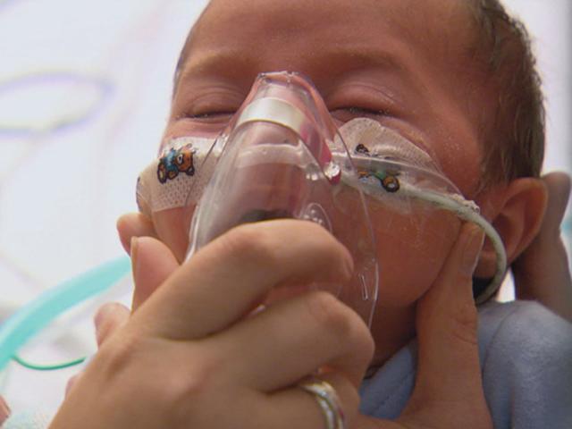 Dấu hiệu viêm phổi ở trẻ sơ sinh sớm và chính xác nhất