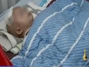 Làm mẹ - Bé 3 tuổi não thụt vào trong hộp sọ vì người lớn thích cưng nựng, rung lắc mạnh