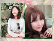 Làm đẹp - Mũi biến dạng, cằm lệch một bên, Phi Thanh Vân đối diện với biến chứng sau nhiều lần dao kéo?