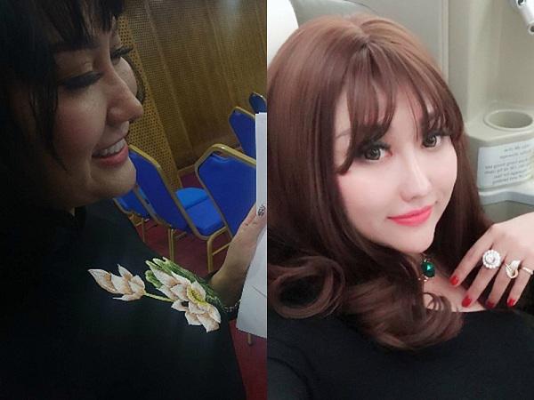 Mũi biến dạng, cằm lệch một bên, Phi Thanh Vân đối diện với biến chứng sau nhiều lần dao kéo? - 9