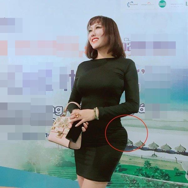 Mũi biến dạng, cằm lệch một bên, Phi Thanh Vân đối diện với biến chứng sau nhiều lần dao kéo? - 10