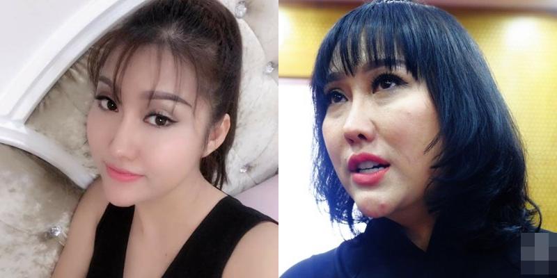Mũi biến dạng, cằm lệch một bên, Phi Thanh Vân đối diện với biến chứng sau nhiều lần dao kéo? - 8