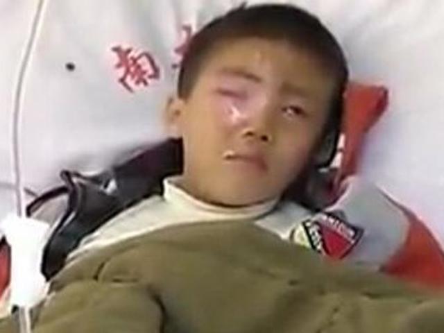 Bé trai mù mắt vì nghịch ngợm gói hút ẩm, đồ vật này tuyệt đối để xa tầm tay trẻ