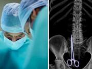 Tin tức - Tưởng bị ung thư, nào ngờ là cây kéo dài 15cm nằm trong bụng suốt 6 tháng