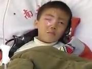 Sức khỏe - Bé trai mù mắt vì nghịch ngợm gói hút ẩm, đồ vật này tuyệt đối để xa tầm tay trẻ