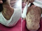 Tin tức - Con gái bị mẹ kế đánh lằn roi kín người, bố ruột chỉ bảo "đánh cho là đúng"