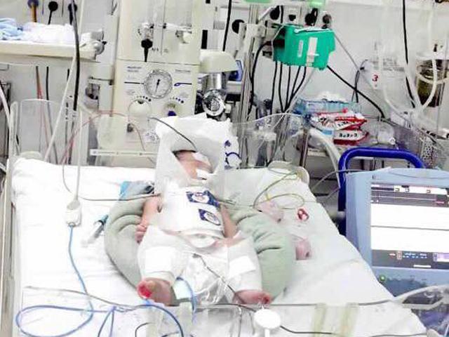 Mẹ Bình Dương vỡ gan ngay khi chuyển dạ, bác sĩ vội vàng mổ cứu thai mới hơn 8 tháng