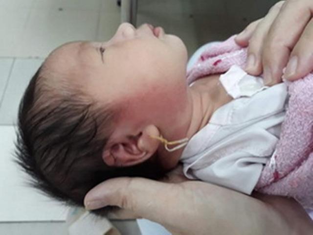 Bé 15 ngày tuổi suýt mất mạng vì xỏ lỗ tai