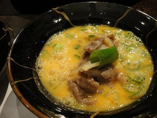 Chị em sinh đôi 2 tuổi nhiễm trùng máu nguy kịch sau khi đi ăn lẩu cùng gia đình