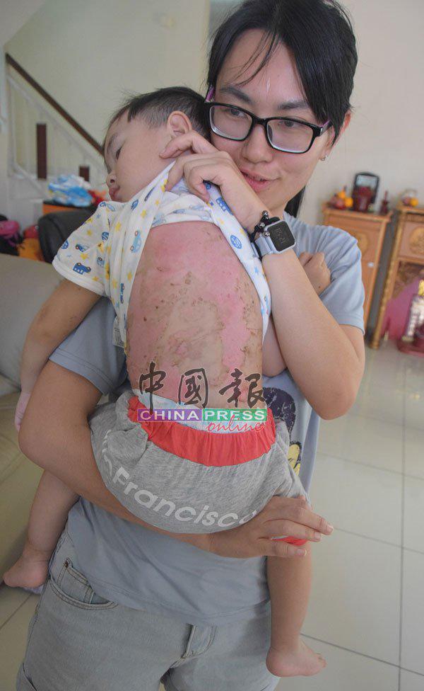 choi cung me trong bep, be trai bi bong nang do bep ga phat no - 2