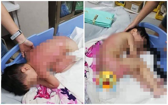 choi cung me trong bep, be trai bi bong nang do bep ga phat no - 1