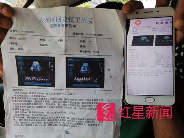 sieu am mang thai doi, len ban sinh me chi de ra mot con, mot dua tre nua o dau? - 4