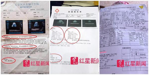 sieu am mang thai doi, len ban sinh me chi de ra mot con, mot dua tre nua o dau? - 3