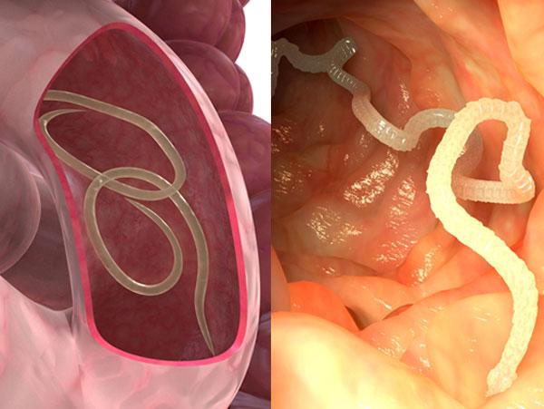 tre bi tieu chay: bac sy khoa nhi chi ra dau hieu va cach dieu tri - 4