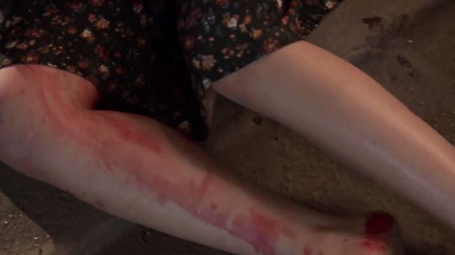 vua tro lai, quynh bup be da dong thai phai nhap vien de gap - 2