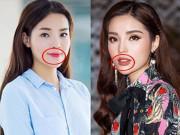 Làm đẹp - Ngoài nâng ngực, độn mông, gọt cằm, các sao còn bị nghi sửa những bộ phận không ngờ đến