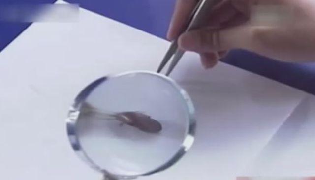 Người đàn ông chết sau 1 ngày nằm viện, thứ cướp đi sinh mạng của ông lại rất nhỏ bé - 3