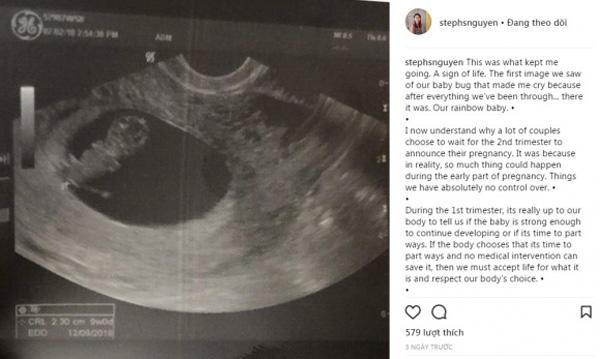 Sinh con sau sảy thai, chị chồng được Tăng Thanh Hà nấu món ngon mang vào tận viện - 4