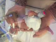 Bà bầu - Chào đời nhỏ như lon nước ngọt, hình ảnh bảnh bao của cậu bé sau 6 tháng gây ngỡ ngàng