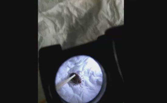 Người đàn ông chết sau 1 ngày nằm viện, thứ cướp đi sinh mạng của ông lại rất nhỏ bé - 5