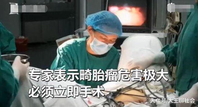 Cô gái 22 tuổi khám sức khỏe tiền hôn nhân, bác sĩ sốc phát hiện có tóc trong buồng trứng - 2