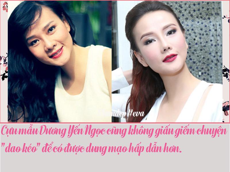 Cựu mẫu Dương Yến Ngọc cũng không giấu giếm chuyện "dao kéo" 
