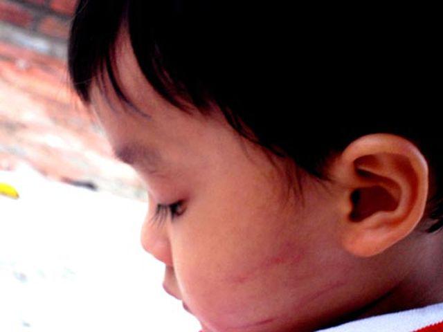 Bé 6 tuổi xuất huyết não sau cái tát của mẹ, 8 bộ phận cơ thể trẻ không được đánh - 6