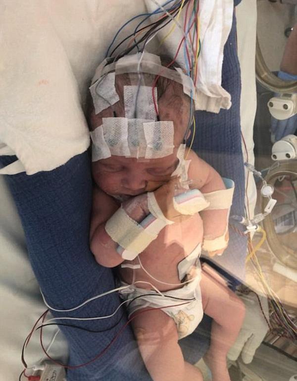 Sinh con khỏe mạnh nhưng vừa đặt bé lên bụng, mẹ đã biết có điều chẳng lành - 1